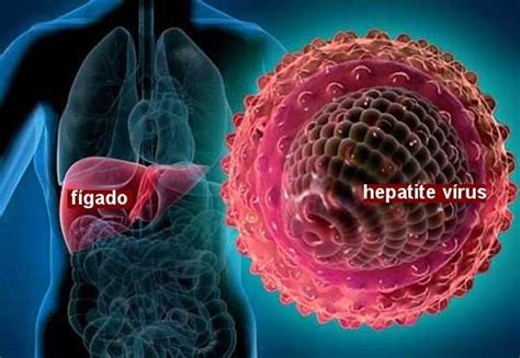surto de hepatite